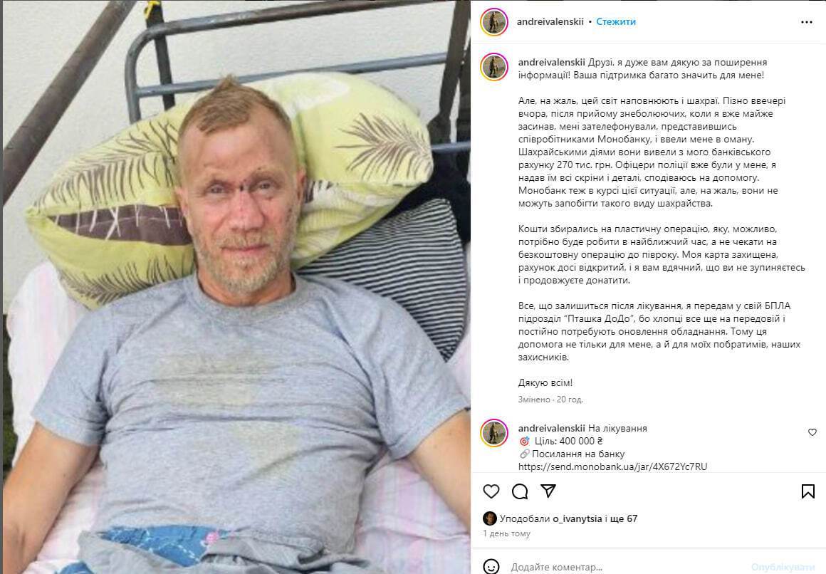 Мошенники похитили 270 тыс. грн с карты украинского актера, которому после ранения на фронте коллеги собирали деньги на операцию