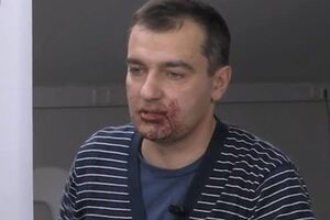Дмитрий Гнап