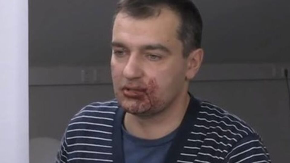 Дмитрий Гнап