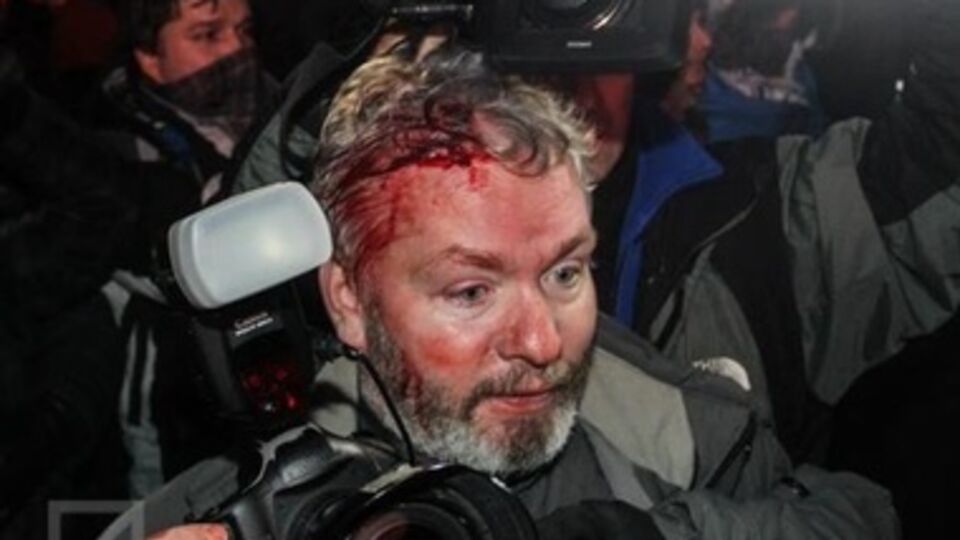 Беркутовец дубинкой разбил голову фотографу. Фоторепортаж