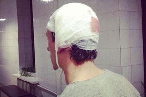 У госпитализированных демонстрантов – травмы головы, ушибы, переломы. Фоторепортаж