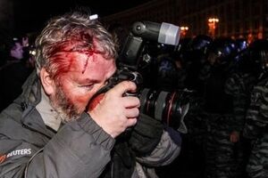 Избитый "Беркутом" фотограф Глеб Гаранич