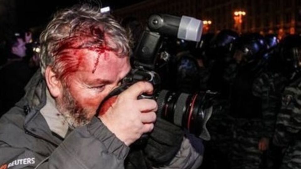 Избитый "Беркутом" фотограф Глеб Гаранич