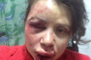 Черновол находится в травмпункте