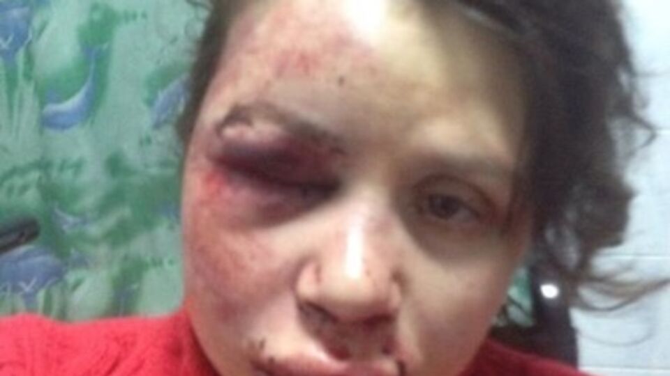 Черновол находится в травмпункте