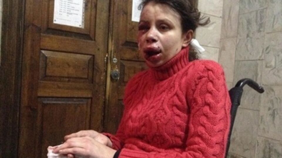 Черновол избили двое неизвестных