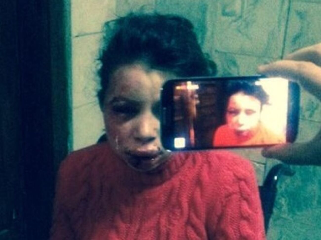 Татьяна Черновол сразу после избиения