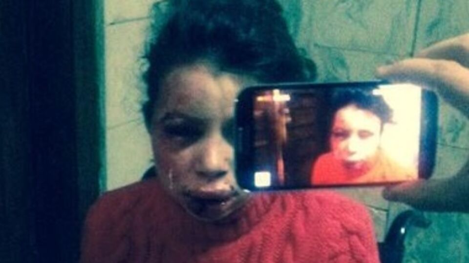 Татьяна Черновол сразу после избиения