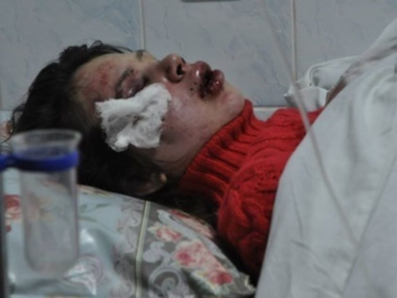 Татьяна Черновол находится в больнице