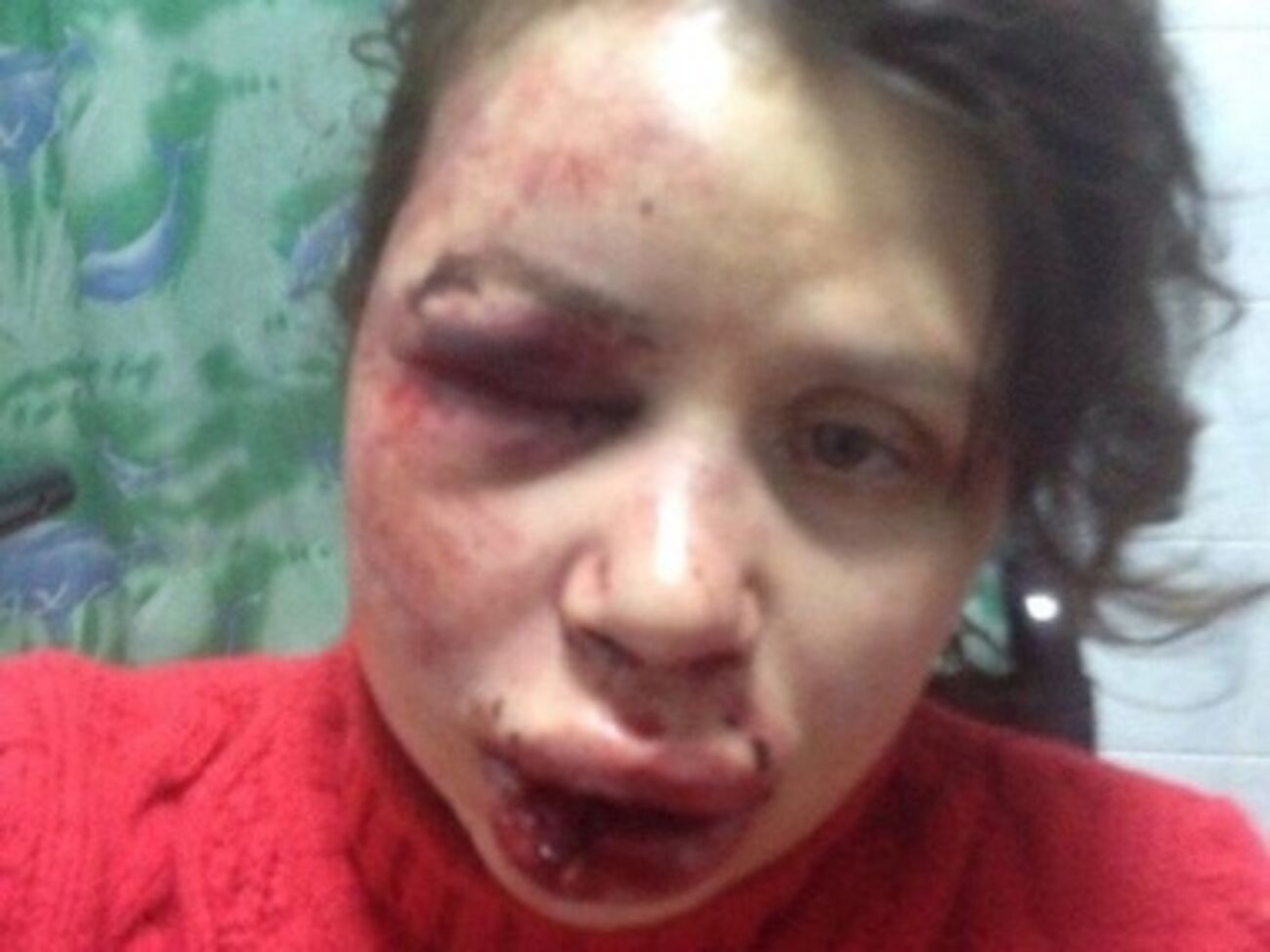 Журналистку избили в ночь на среду