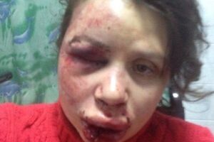 Журналистку избили в ночь на среду