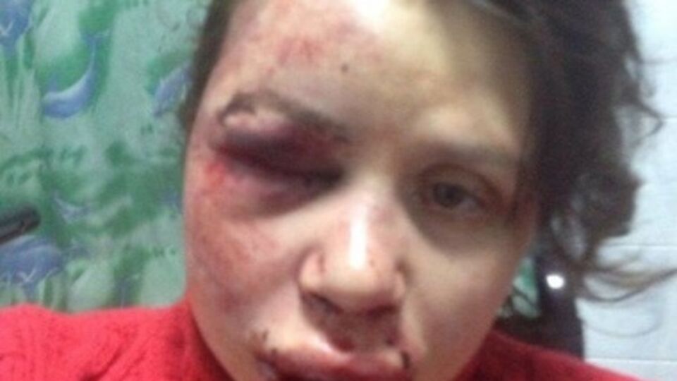 Журналистку избили в ночь на среду