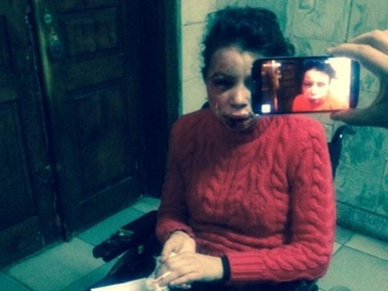 Татьяна Черновол после избиения