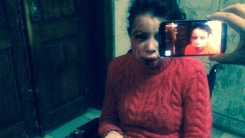 Татьяна Черновол после избиения