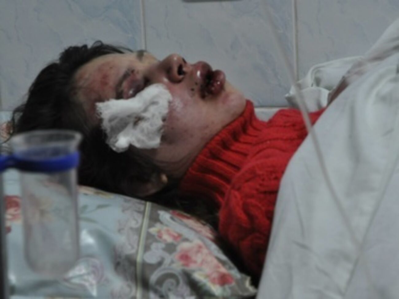 Татьяна Черновол после избиения