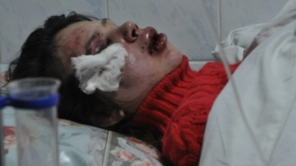 Татьяна Черновол после избиения