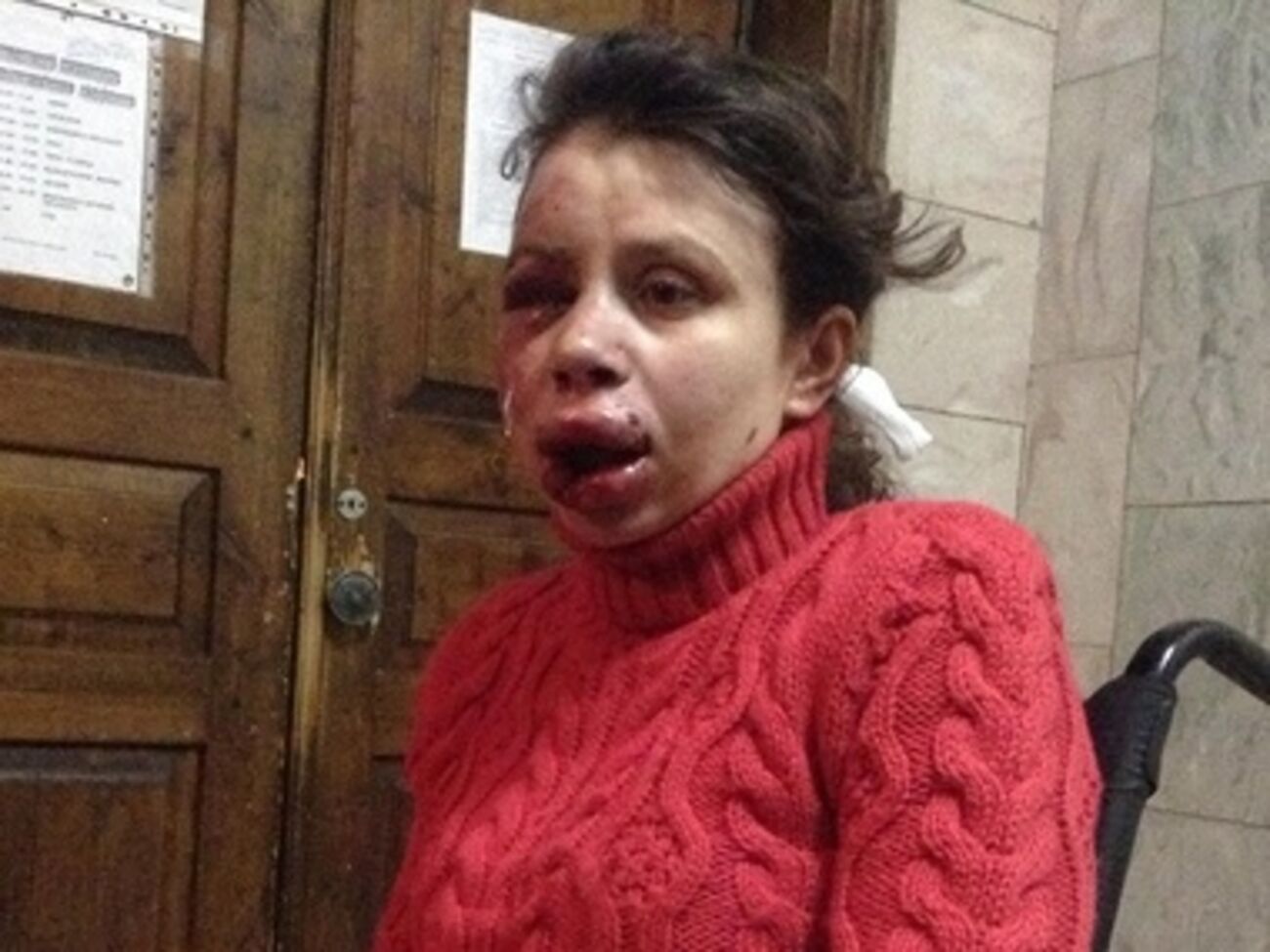 Черновол после избиения