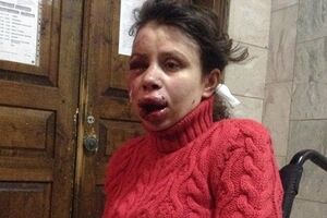 Черновол после избиения