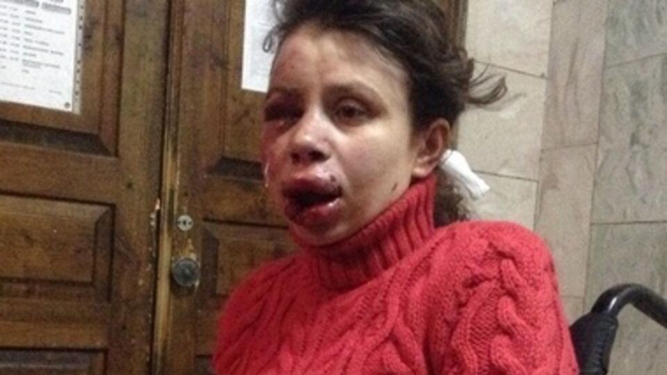 Черновол после избиения