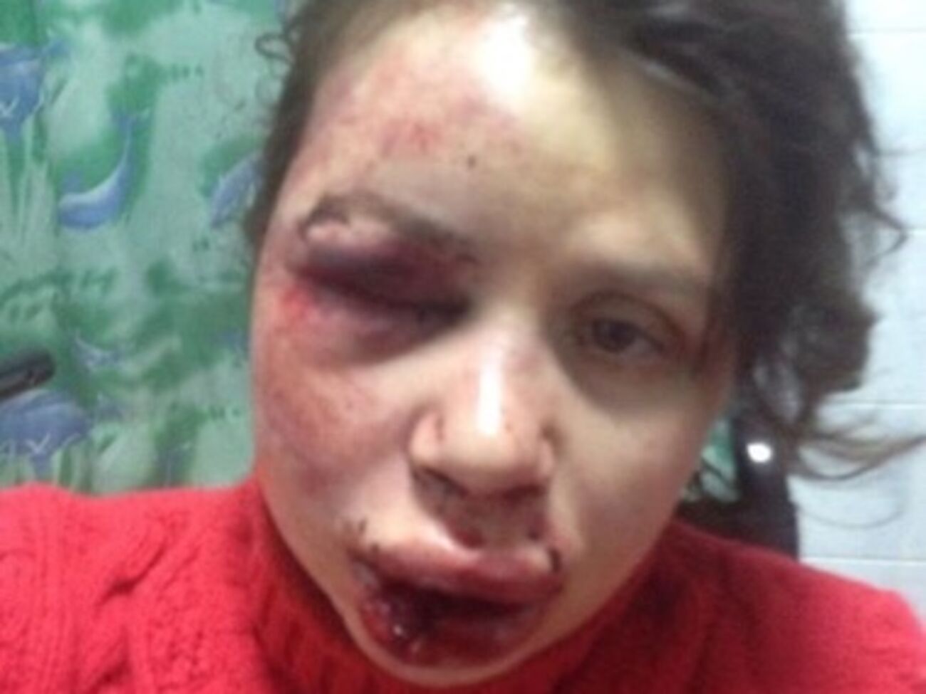 Черновол находится в клинике "Борис"