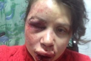 Черновол находится в клинике "Борис"