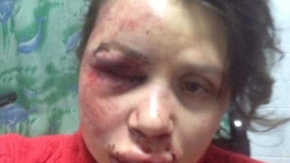 Черновол находится в клинике "Борис"