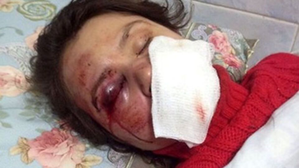 Татьяна Черновил после нападения