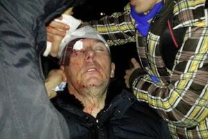 Юрия Луценко забрала "скорая"