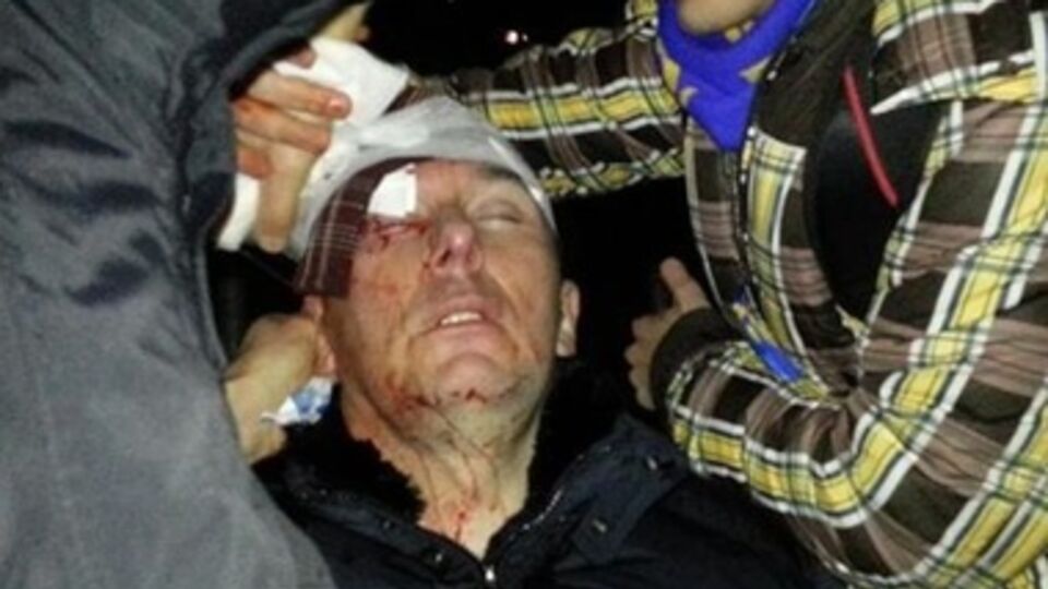 Юрия Луценко забрала "скорая"