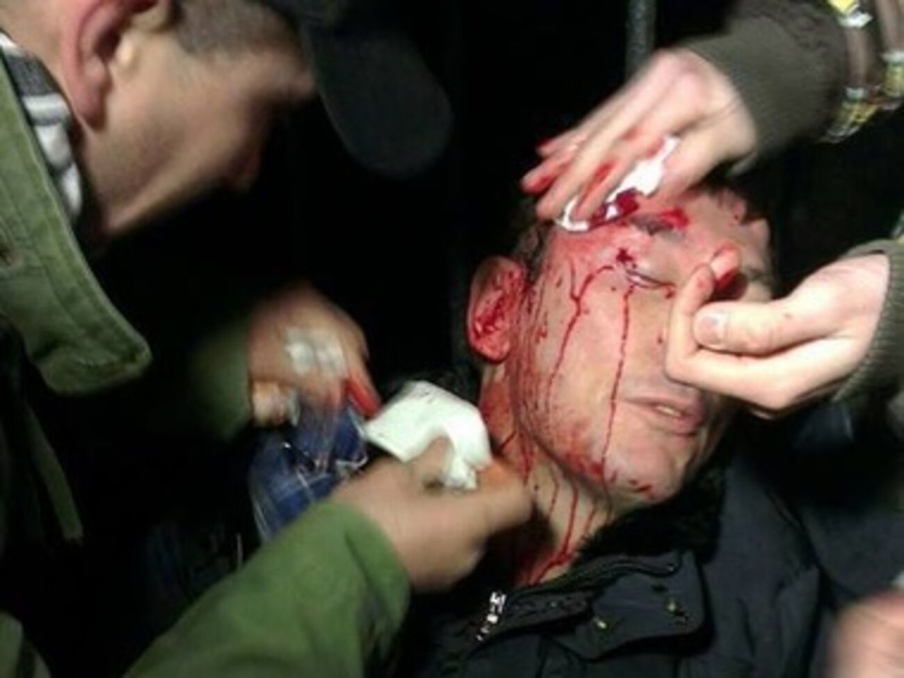 Юрию Луценко оказывают первую помощь