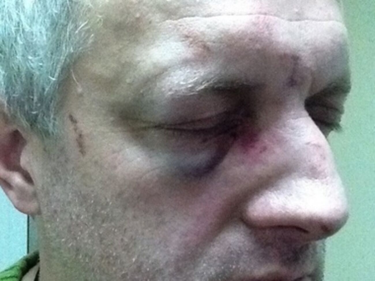 Пострадавшего&nbsp;госпитализировали