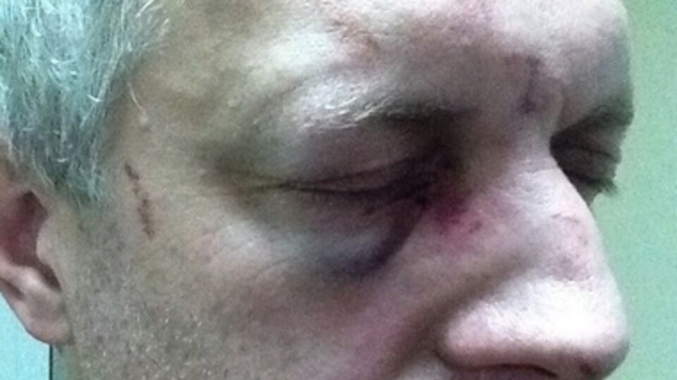 Пострадавшего госпитализировали