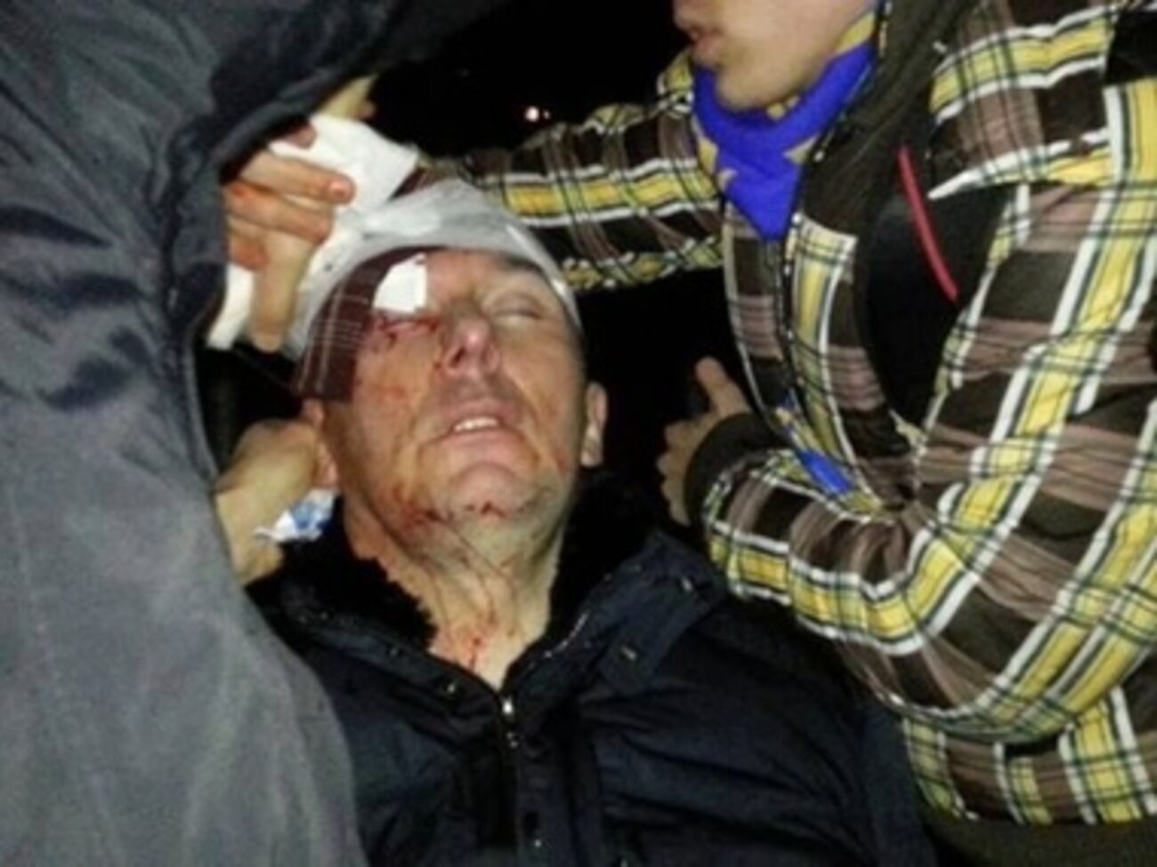 Юрия Луценко избили беркутовцы