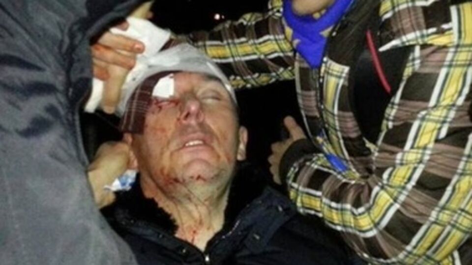 Юрия Луценко избили беркутовцы