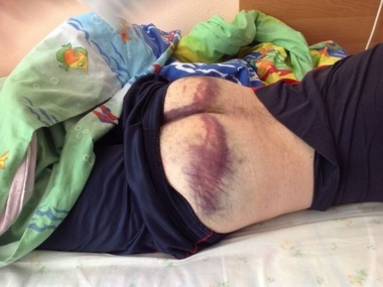 Во время разгона митинга в Черкассах "Беркут" избивал случайных прохожих. Фоторепортаж