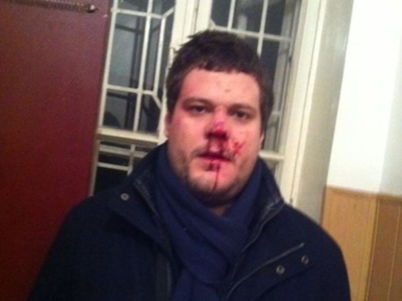 Депутат Андрей Ильенко после избиения