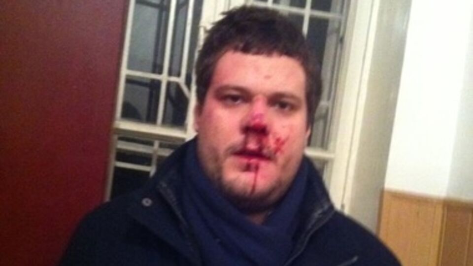 Депутат Андрей Ильенко после избиения