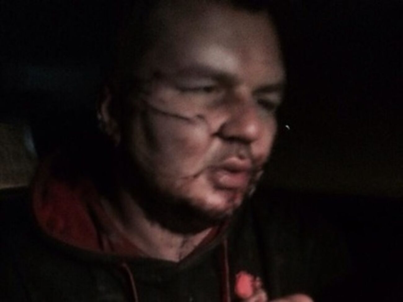 Булатова будут лечить бесплатно