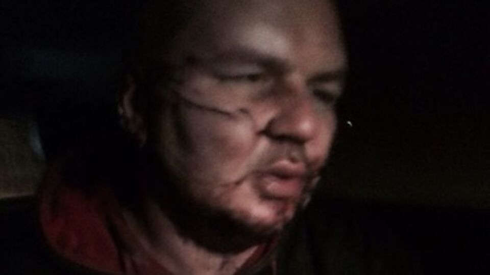 Булатова будут лечить бесплатно