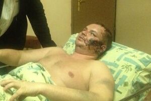 У Булатова множество травм