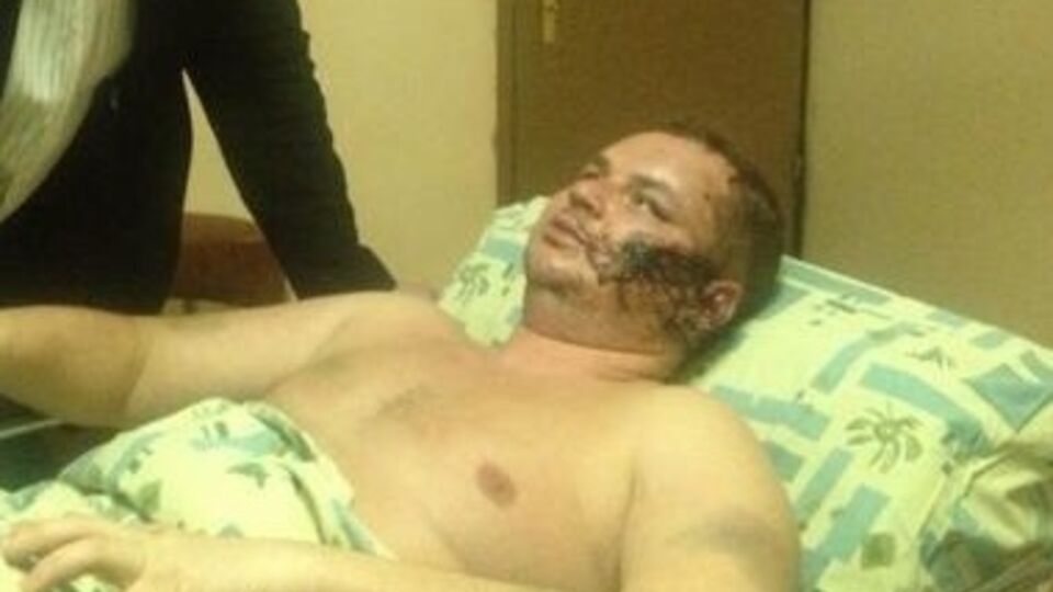 У Булатова множество травм