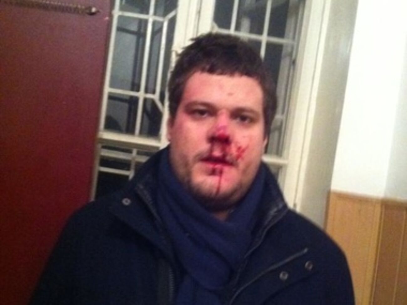 У Ильенко сотрясение мозга