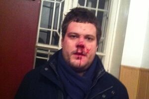 У Ильенко сотрясение мозга