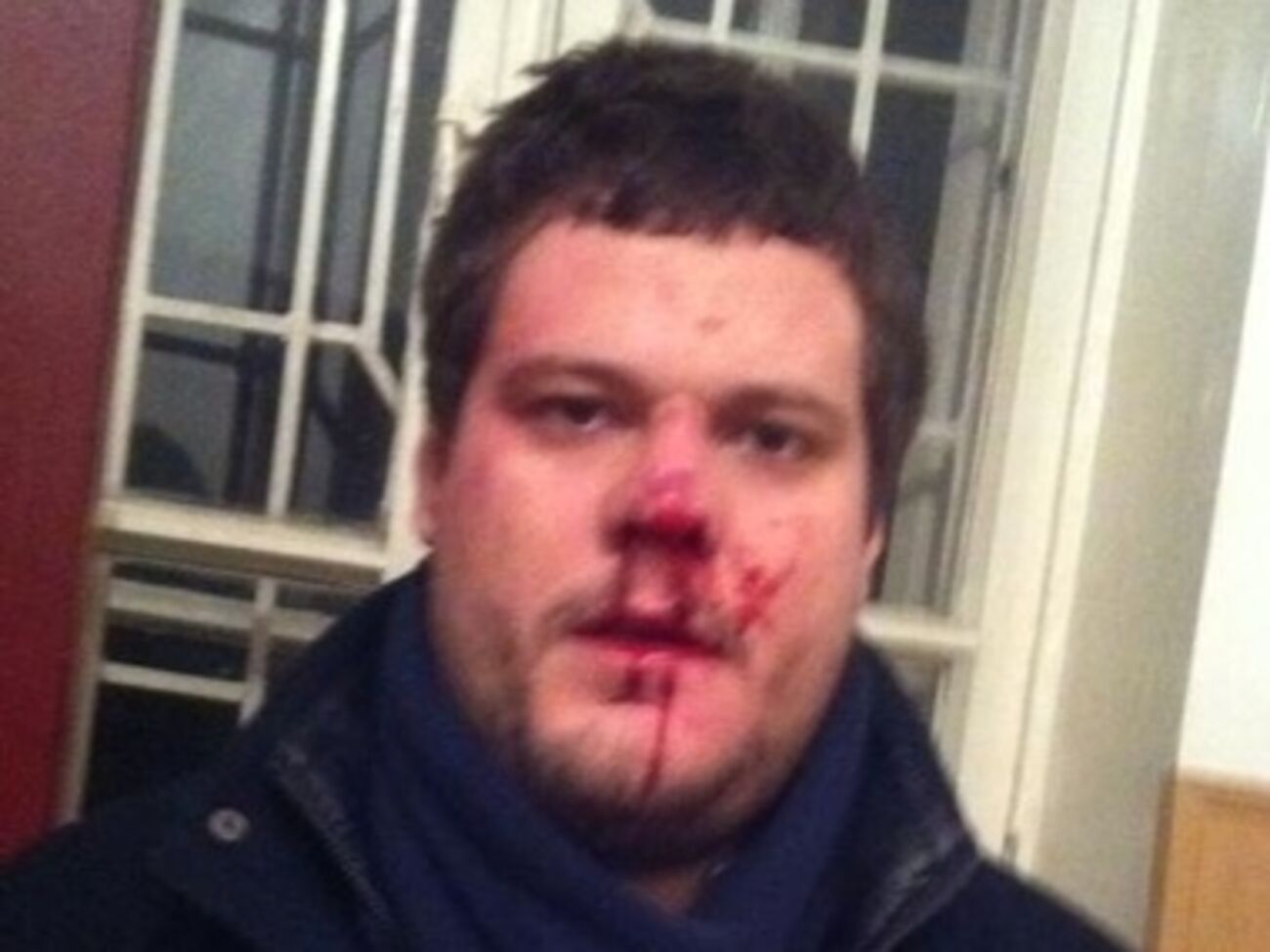 Андрея Ильенко избили 3 января