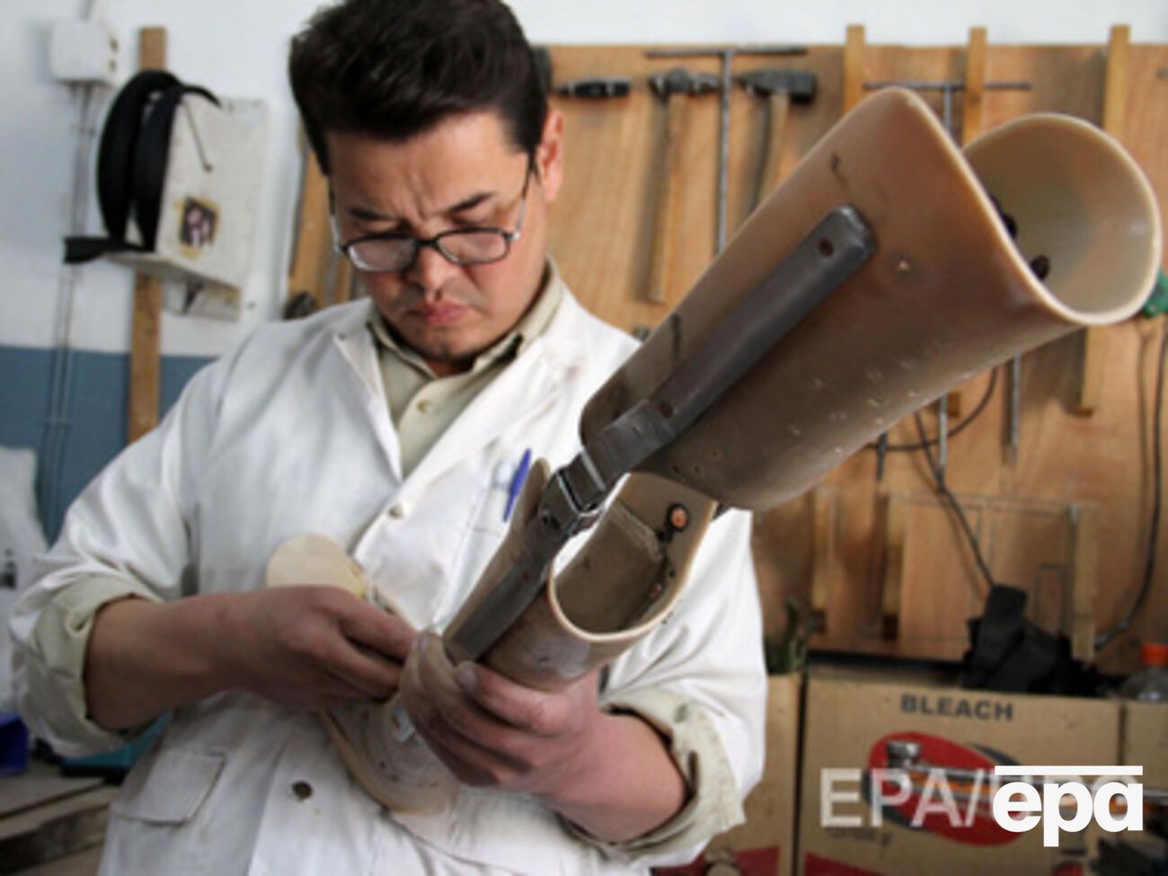 За границу будут отправлять на протезирование в особо сложных случаях