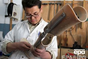 За границу будут отправлять на протезирование в особо сложных случаях