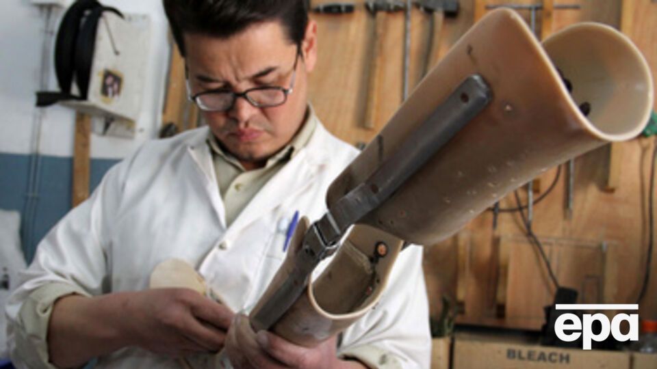 За границу будут отправлять на протезирование в особо сложных случаях