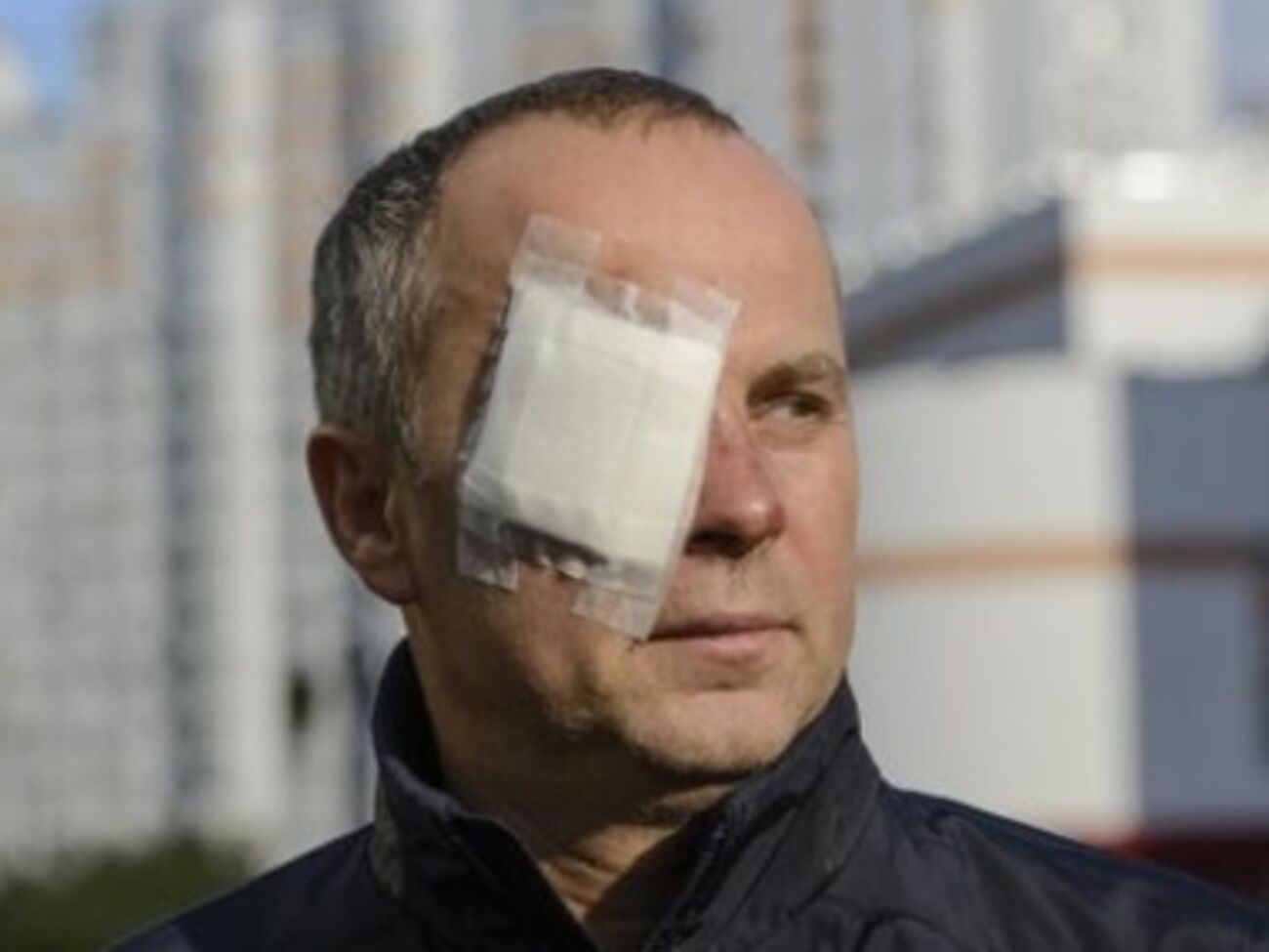 Шуфрича избили в Одессе