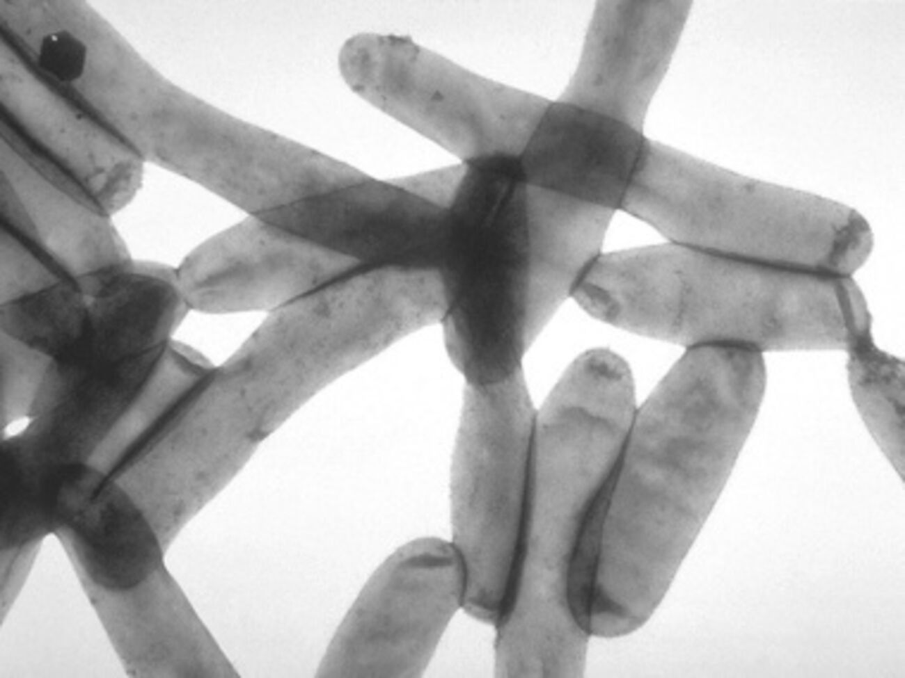 Источник инфекции обнаружить пока не удалось