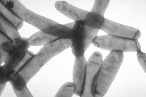 Источник инфекции обнаружить пока не удалось